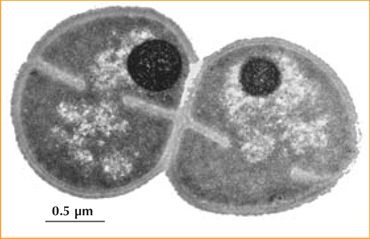 deinococcus-radiodurans